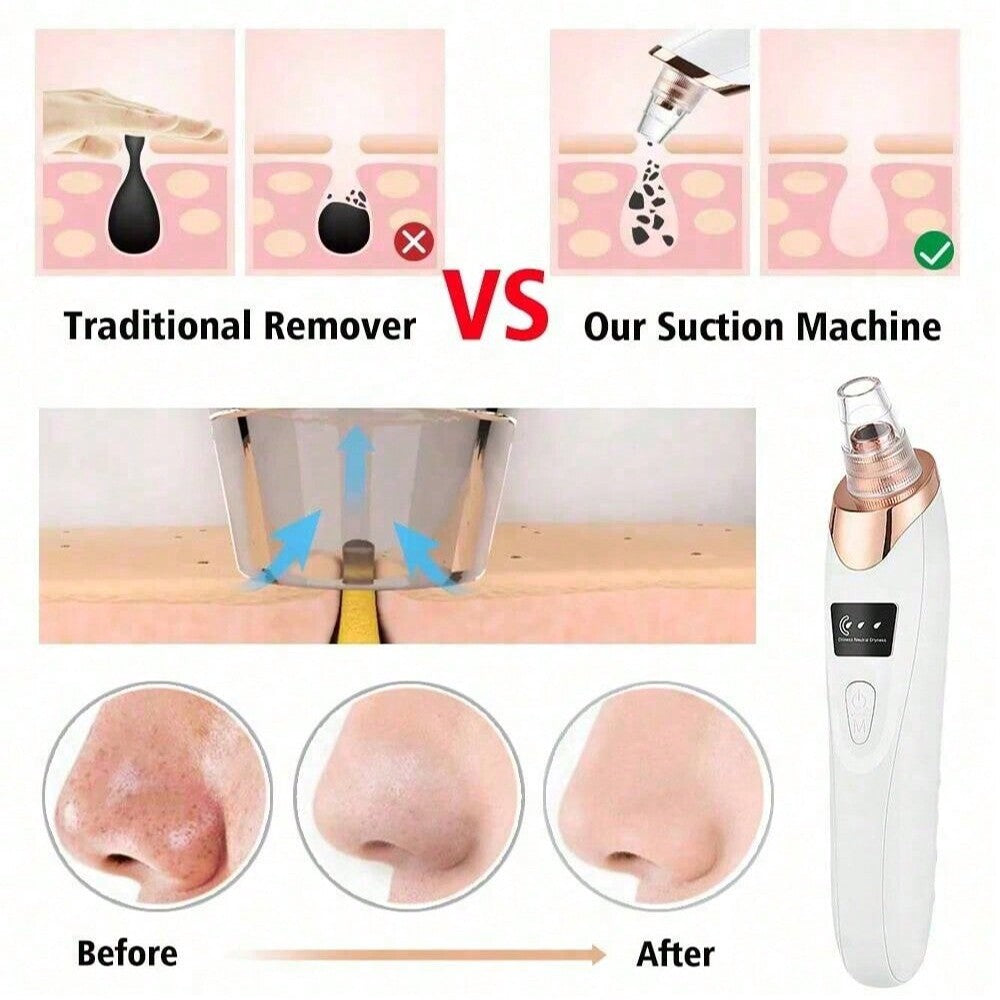 Velora™ – Electric Acne Pore Cleaner &amp; Blackhead Remover